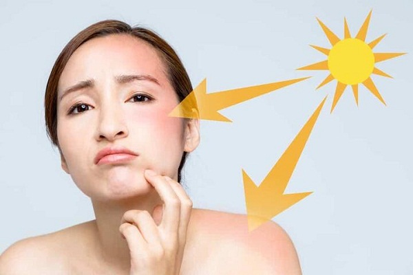 Những người làm việc ngoài trời dễ bị nám nắng.