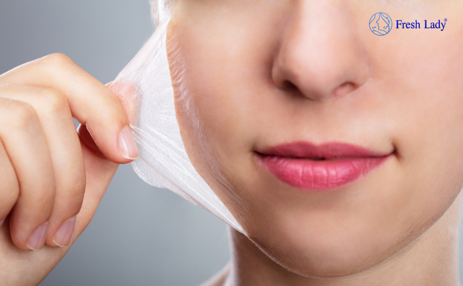 Peel da trị nám là như thế nào?