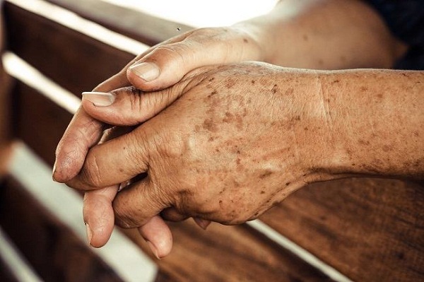 Người lớn tuổi thường bị nám trên tay.