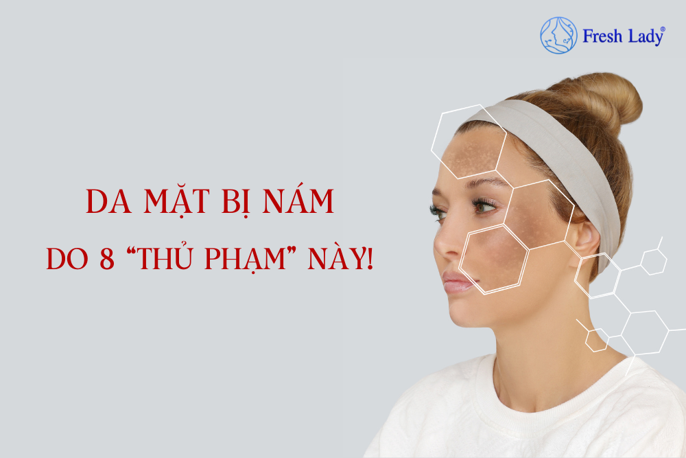 Da mặt bị nám do 8 “thủ phạm” này!