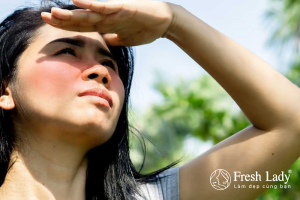 Tia UV từ ánh nắng mặt trời kích thích mạnh mẽ melanocyte tăng sản xuất melanin.