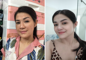 Tôi thử không biết bao nhiêu sản phẩm từ nội địa Việt đến hàng nhập khẩu Hàn, Nhật, Mỹ. Nhưng không có kết quả. - Chị Hà chia sẻ