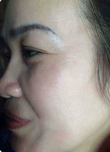 Kem trị nám Fresh Lady