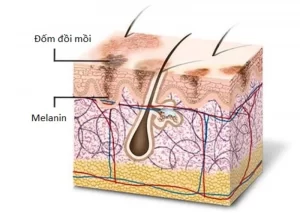 Melanin được tạo ra để bảo vệ da khỏi tia UV một cơ chế tự nhiên của cơ thể.