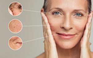 Nguyên nhân lão hóa da đến từ yếu tố ngoại sinh và nội sinh