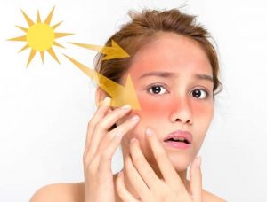 Việc tiếp xúc với ánh mặt trời (tia UV) mà không được che chắn kỹ. Cũng rất dễ hình thành nám mảng, nám chân sâu.