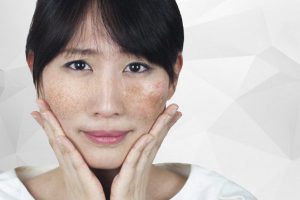 Các chị em cần phải nám rõ cơ chế hình thành của nám. Từ đó giúp cho việc điều trị hiệu quả hơn.